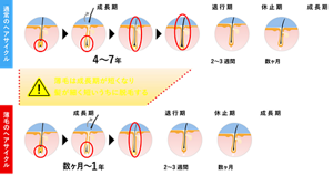 （1）通常のヘアサイクル・・・成長期4～7年、退行期2～3週間、休止期数ヶ月（2）薄毛のヘアサイクル・・・成長期数ヶ月～1年、退行期2～3週間、休止期数ヶ月　薄毛は成長期が短くなり髪が細く短いうちに脱毛する。