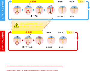 髪は、成長期 → 退行期 → 休止期を繰り返して生え替わります。しかし、思春期以降、髪が細く短くなっていく現象がみられる場合があります。これは、成長期を短くする指令が出て、細く短いまま抜け落ちることが繰り返されるためです。つまり、太く長く強い髪を育むためには、髪の成長期を保つことが大事なのです。（図）通常のヘアサイクルでは、成長期が4～7年、退行期が2～3週間、休止期が数カ月。薄毛のヘアサイクルになると、成長期が数カ月～1年と短くなる。