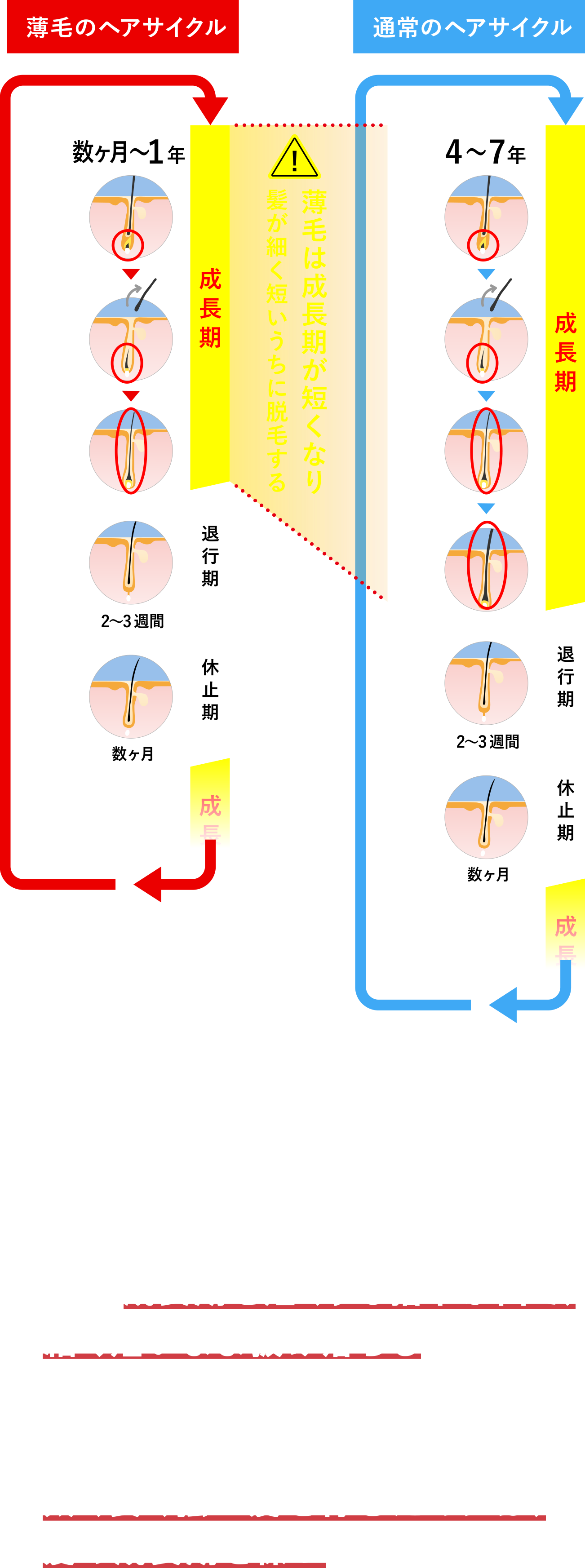 薬用育毛トニック ボリュームケア｜サクセス