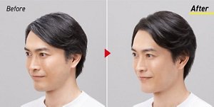 Before／After