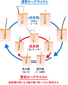 通常のヘアサイクル・薄毛のヘアサイクル
