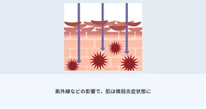 1.紫外線などの影響で、肌は微弱炎症状態に。