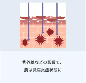 1.紫外線などの影響で、肌は微弱炎症状態に。