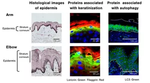 Figure 1, Comparison of elbow and arm skin tissue, and distribution of proteins associated with keratinization and autophagy