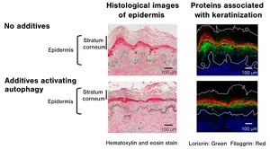 Figure 2, Observation of changes in keratinization from autophagy activation in cultured elbow skin tissue with hyperkeratosis