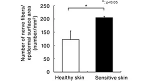 Figure 3. Comparing healthy skin and sensitive skin reveals a significant difference in the number of nerves that extend to immediately below the stratum corneum.