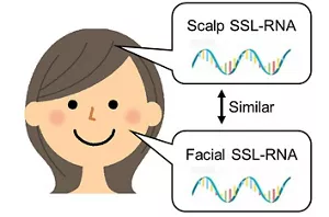 Illustration showing that the expression patterns of facial and scalp SSL-RNA are similar.