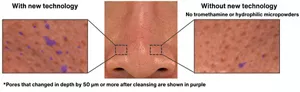 Photographs showing examples of notable changes in the depth of the pores after cleansing with or without the new technology.