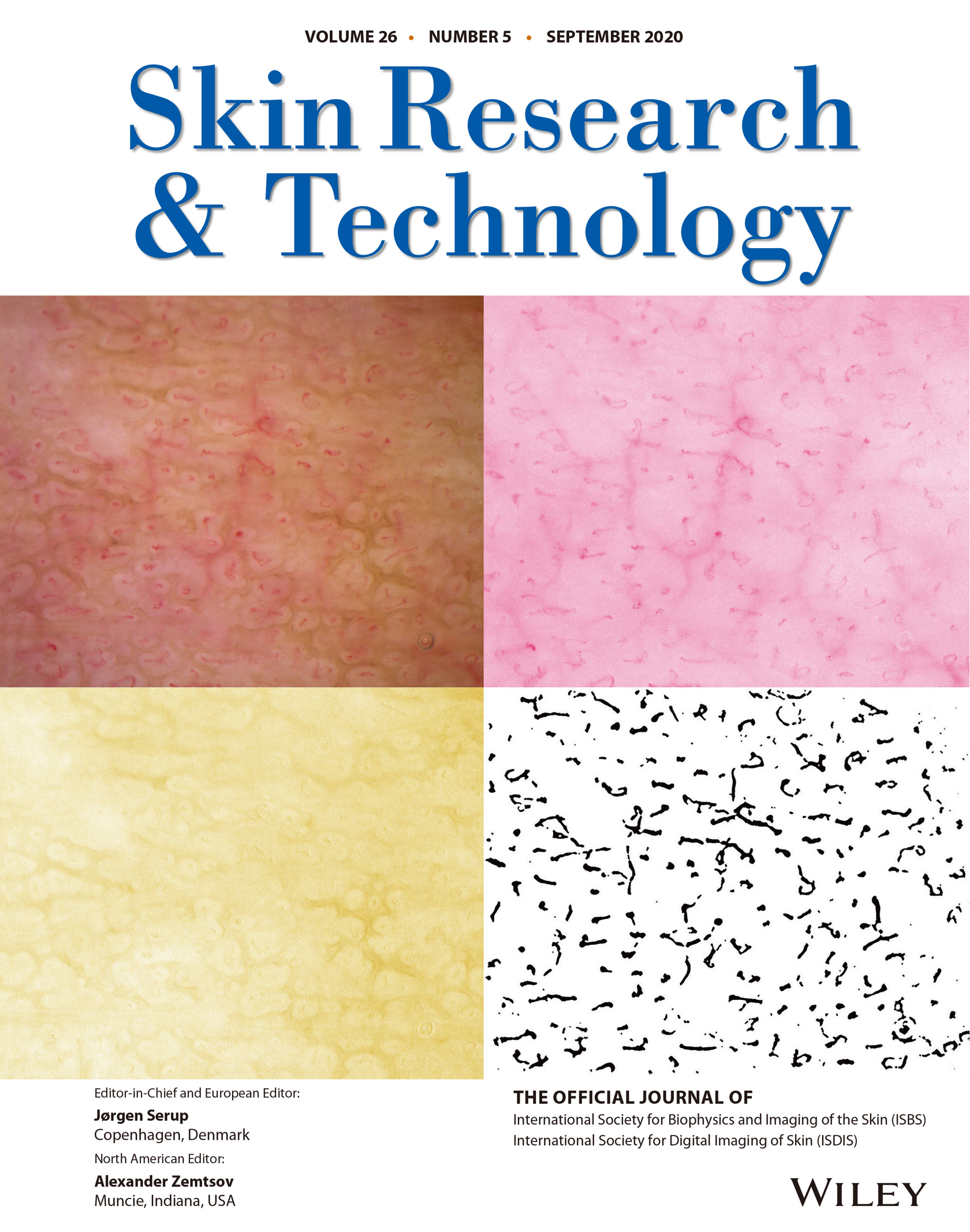 花王 血管画像自動抽出技術を用いて皮膚深部の血管と毛細血管の血流情報を同時に検出