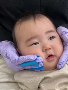 乳児の皮脂を採取する様子