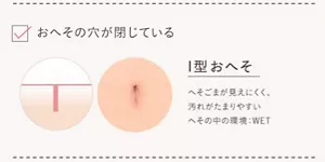 I型のおへその画像。おへその穴が閉じている。