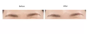 眉間に本商品を塗布した場合のBefore・Afterが分かるイメージ写真