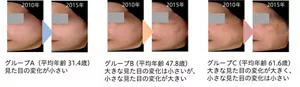 2010年から2015年のグループ別の変化パターンのイメージ グループA（平均年齢31.4歳） 見た目の変化が小さい グループB（平均年齢47.8歳） 大きな見た目の変化は小さいが、小さな見た目の変化が大きい グループC（平均年齢61.6歳） 大きな見た目の変化が大きく、小さな見た目の変化は小さい