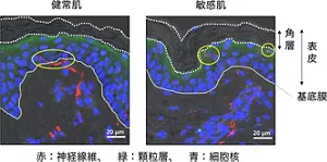 図1. 健常肌では神経線維がタイトジャンクションの機能により角層より深部にあるが、敏感肌では、角層直下まで伸長している