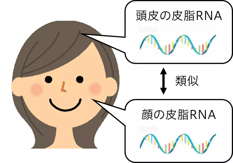 顔と頭皮で皮脂RNAの発現パターンが類似することを示したイラスト