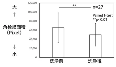 洗顔前と、新技術ありの洗顔料で洗顔した後における、角栓面積合計を示したグラフ