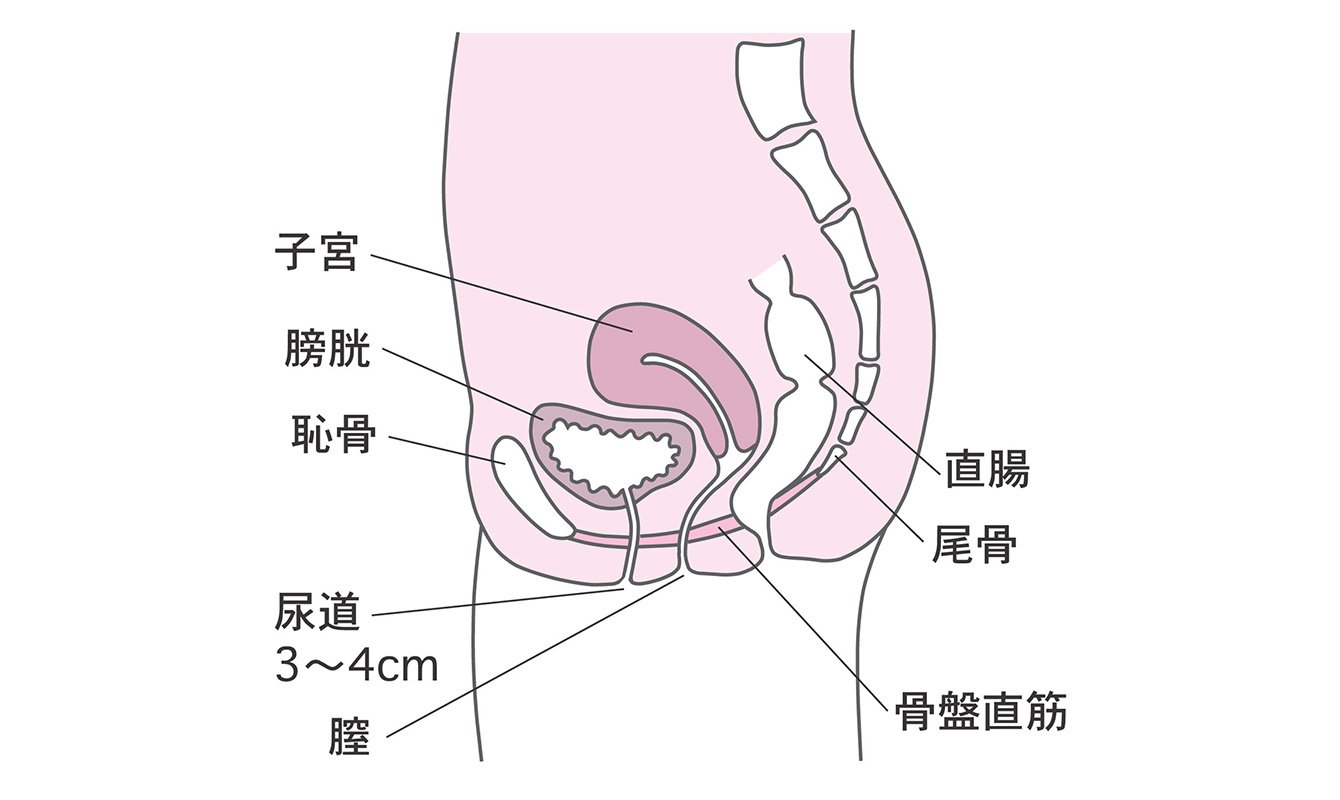 子宮 筋腫 頻 尿