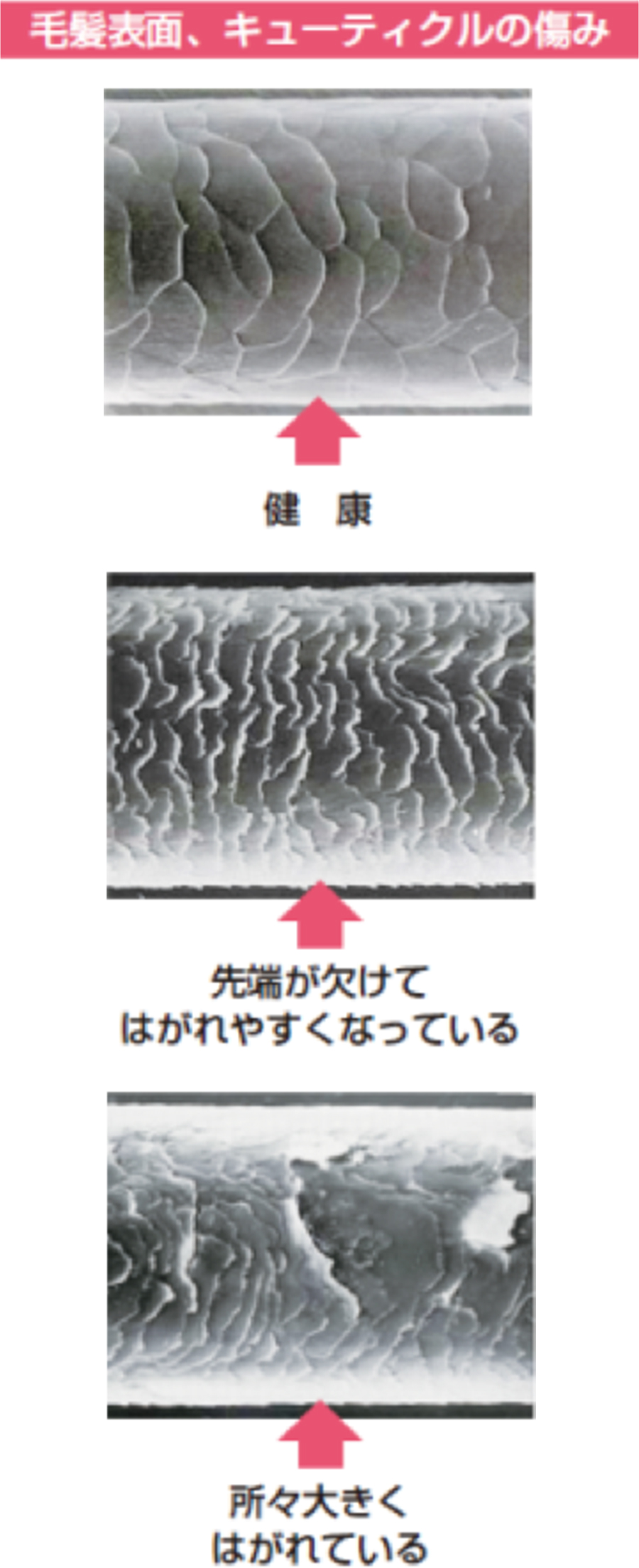 キューティクルの傷み 髪の知識 花王株式会社 ヘアケアサイト キューティクルの傷み 髪の知識 花王株式会社 ヘアケアサイト