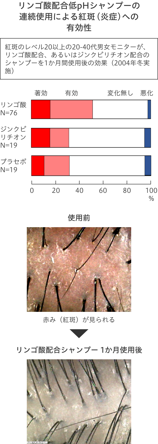 頭髪洗浄と頭皮ケア 花王の髪と頭皮の研究と技術 花王株式会社 ヘアケアサイト 頭髪洗浄と頭皮ケア 花王の髪と頭皮の研究と技術 花王株式会社 ヘアケアサイト