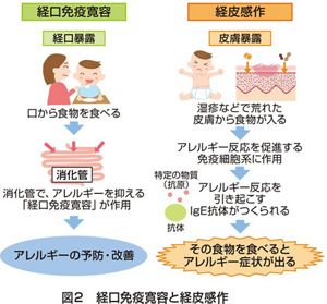【全訂新版】年代別アレルギー疾患への対応 症例を通して学ぶ年代別食物アレルギーのすべて | 海老澤 元宏
