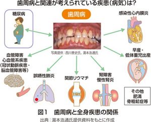 花王 | 花王健康科学研究会 | 歯周病が全身に及ぼす影響