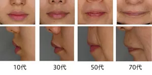 図：10代、30代、50代、70代の各代表的な唇の正面図、側面図を一例ずつ表示、唇全体の縦幅は、加齢とともに狭くなり、横幅は加齢とともに広がる。下唇は加齢とともに、側面からの膨らみが減少する。鼻の下は加齢とともに長くなる。