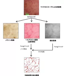 マイクロスコープで得られた皮膚画像から独立成分分析により、メラニン画像、ヘモグロビン画像、陰影画像を抽出します。その後、フィルター処理技術により、毛細血管画像を抽出するアルゴリズムの説明図になります。
