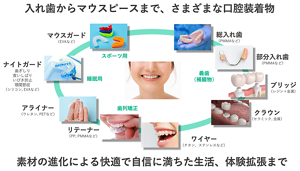 入れ歯や義歯だけではない「口腔装着物」。マウスガードや歯列矯正用のアライナーなど、様々な用途に広がっている。