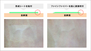 形成シートを貼り付けた肌とファインファイバーを直接吹き付けた肌の比較