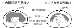 図1　内臓脂肪型肥満と皮下脂肪型肥満の臍位断面の模式図。内臓脂肪蓄積型肥満は、内臓に脂肪が多く蓄積し、皮下脂肪型肥満は、皮下に脂肪が多く蓄積するのが特徴であることを示す。