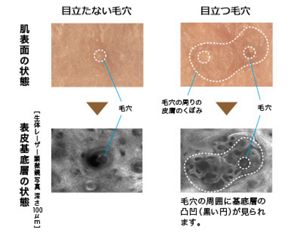 花王  スキンケアナビ  ほおの毛穴の研究