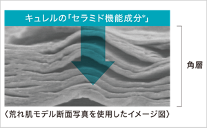 荒れた角層に“セラミド機能成分”が浸透していくイメージ