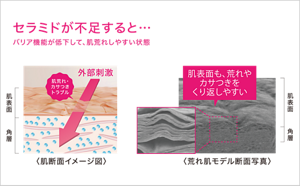 セラミドが不足し、外部刺激が入り込みやすく乾燥して敏感になっている角層イメージ
