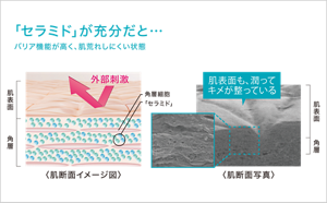 角層が乱れ、肌表面も荒れやカサつきを繰り返す不安定なイメージ