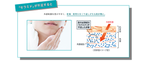 「セラミド」が不足すると外部刺激を受けやすく、乾燥・肌荒れをくり返しがちな肌状態に。