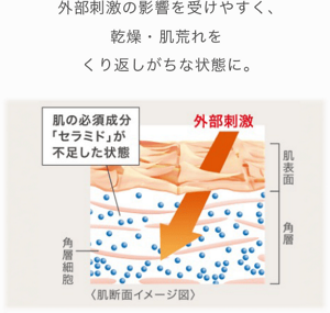 外部刺激の影響を受けやすく、 乾燥・肌荒れを くり返しがちな状態に。