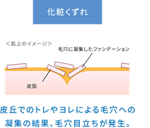 化粧くずれ ＜肌上のイメージ＞ 毛穴に凝集したファンデーション 皮脂 皮丘でのトレやヨレによる毛穴への 凝集の結果、毛穴目立ちが発生。
