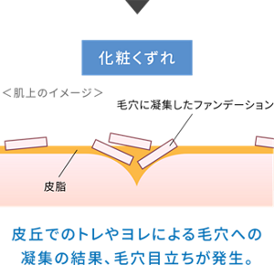 化粧くずれ ＜肌上のイメージ＞ 毛穴に凝集したファンデーション 皮脂 皮丘でのトレやヨレによる毛穴への 凝集の結果、毛穴目立ちが発生。