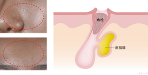 エスト クラリファイイング ジェルウォッシュ MED 発売