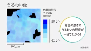 うあうろい像　角層細胞のうるおい（含水比）　青色の濃さでうるおいの程度が一目でわかる！　　※画像例