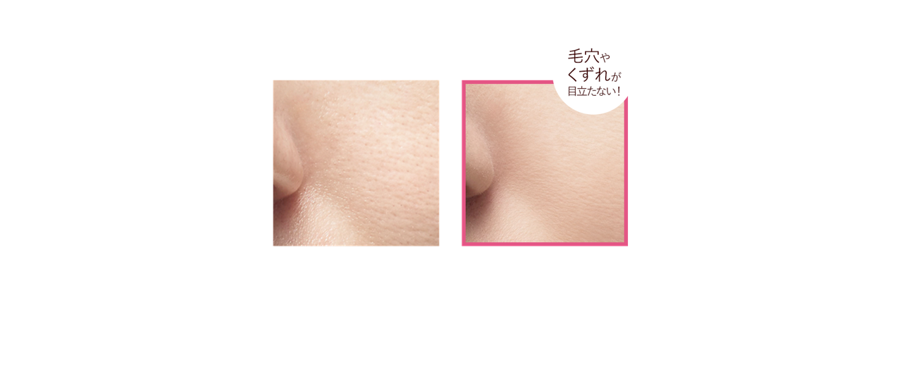 å¤æ¹ã®æ¯ç©´ã®ã¤ã¡ã¼ã¸ æ¯ç©´ãããããç®ç«ããªãï¼