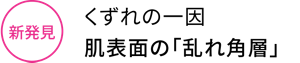新発見 くずれの一因 肌表面の「乱れ角層」