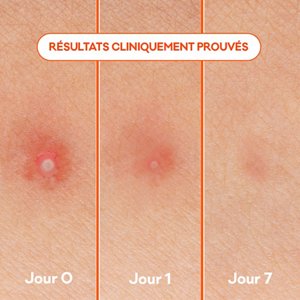 139225_Biore_EMEA_FR_Secondary_Asset_Adapt_28