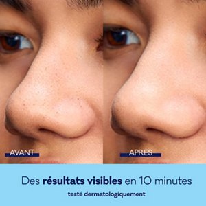 139224_BIO_FR_Pore_Strip_E-content_Refresh_BeforeAfter_Square_R1