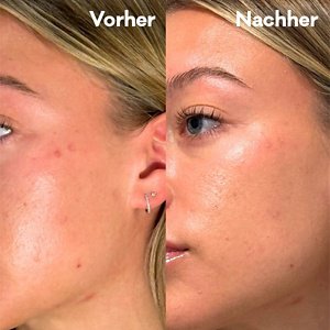 137846_Biore_DE_Peel_Off_Gel_1_600_600px