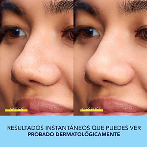 KAO-115699 - SB Bioré Website Update Assets Witch Hazel Pore Strips 400x400