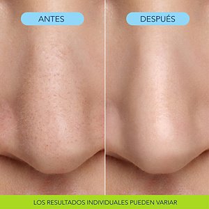 KAO-115699 - SB Bioré Website Update Assets Bubbling Nose Mask 400x400