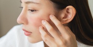 Woman with sensitive skin touching her cheek