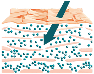 Skin_Barrier1_Desktop