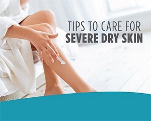 foot-severedryskin
